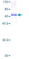 Human CTH / Cystathionase Protein (Recombinant GST)