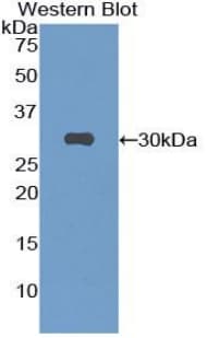 IL2RA / CD25 Antibody (aa22-235)