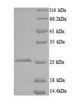 Mouse CCN5 Protein (Recombinant 6His, N-terminus)