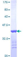 Human ERBB2IP / Erbin Protein (Recombinant GST, N-terminus)