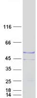 Human TSPY2 Protein (Recombinant Myc-DDK (Flag))