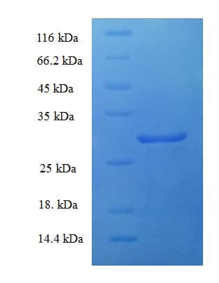 Human PTHR2 / PTH2R Protein (Recombinant His-SUMO)