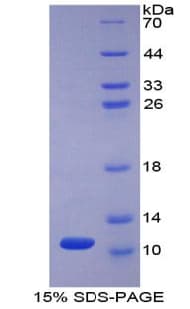 Human PI3 / Elafin Protein (Recombinant His)