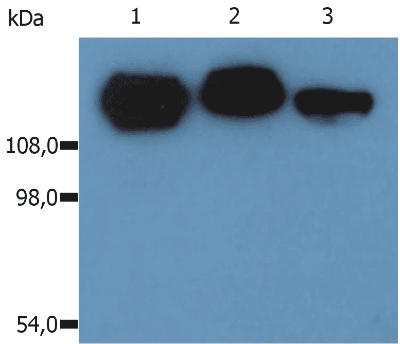 Monoclonal Mouse anti-Human ITGB1 / Integrin Beta 1 / CD29 Antibody (clone MEM-101A, WB)
