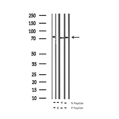 ZAP70 Antibody (phospho-Tyr493)