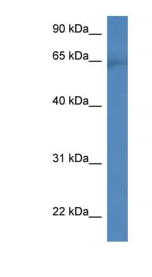 Polyclonal Rabbit anti-Human CACNB2 Antibody (aa449-498, WB)