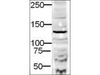 Polyclonal Rabbit anti-Human DIAPH2 Antibody (C-Terminus, WB)
