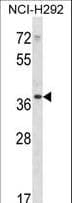 PDLIM1 Antibody (aa254-282)