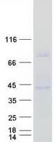 Human CD1C Protein (Recombinant Myc-DDK (Flag))