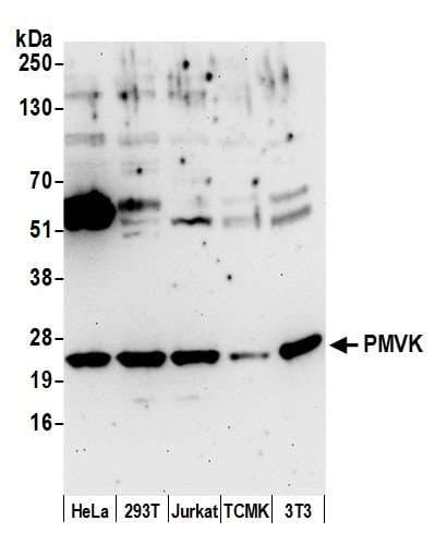 PMVK Antibody (aa142-192)