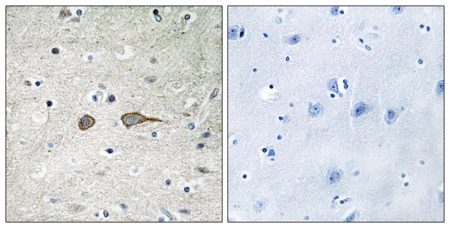 DENN / MADD Antibody