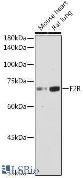 Polyclonal Rabbit anti-Human F2R / Thrombin Receptor / PAR1 Antibody (WB)