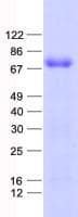 Human ZNF655 Protein (Recombinant His, N-Terminal)