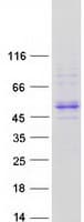 Human ALLC Protein (Recombinant Myc-DDK (Flag))