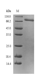 Mouse CCK4 / PTK7 Protein (Recombinant 6His, N-terminus)