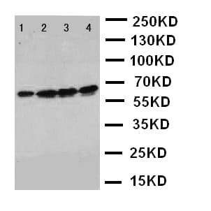 FSCN1 / Fascin Antibody (aa97-113)