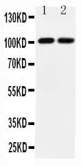 GRIA3 / GLUR3 Antibody (aa394-412)