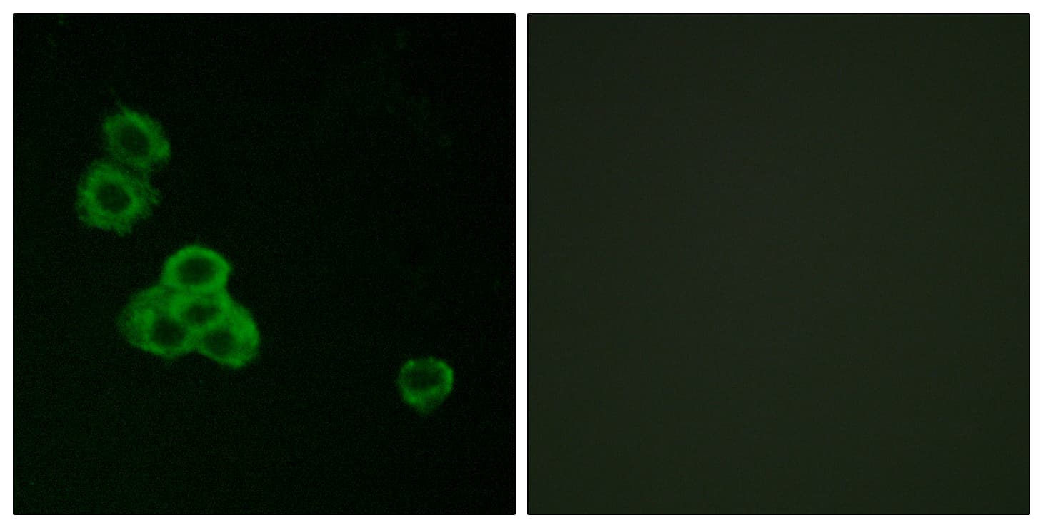 CaMKII Alpha+Delta Antibody (Internal)