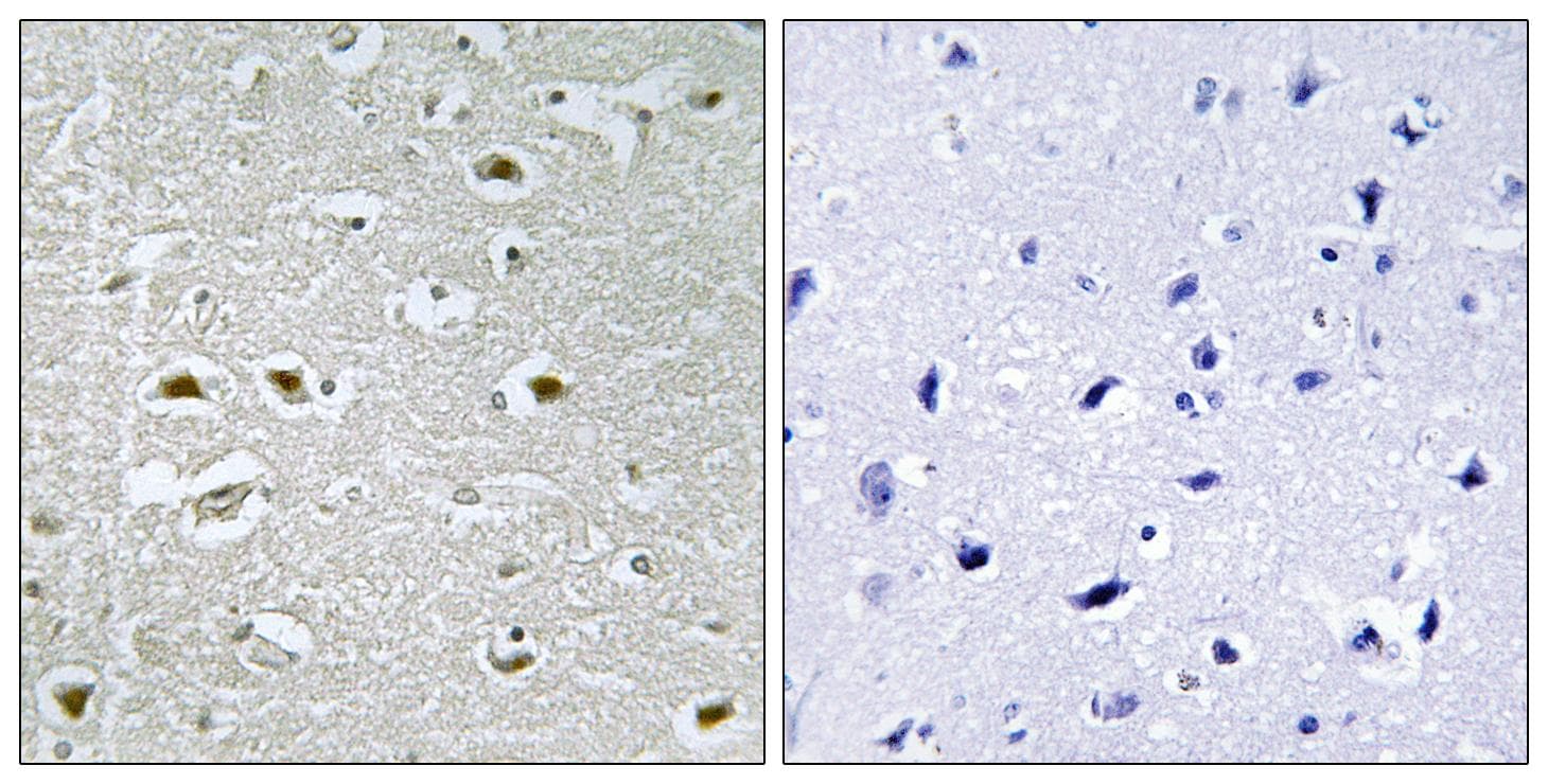 URB1 Antibody