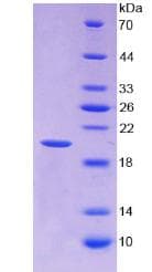 Mouse ANXA4 / Annexin IV Protein (Recombinant His)