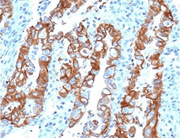 TROP2 / TACSTD2 Antibody (clone TCSR2-1)
