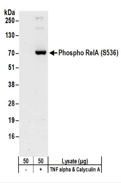 Polyclonal Rabbit anti-Human RELA / NFKB p65 Antibody (phospho-Ser536, IHC, WB)