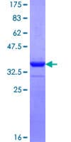 Human FNDC5 / Irisin Protein (Recombinant GST, N-terminus)