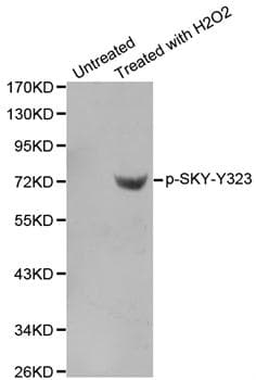 SYK Antibody (phospho-Tyr323)