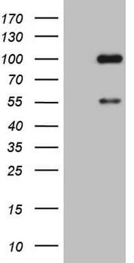 ADAMTS4 Antibody (aa296-577, clone OTI6F8)
