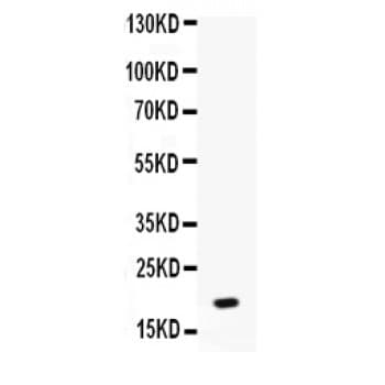 CXCL7 / PPBP Antibody (aa55-128)