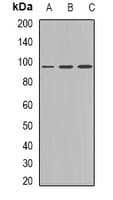 PKP2 / Plakophilin 2 Antibody (C-Terminus)