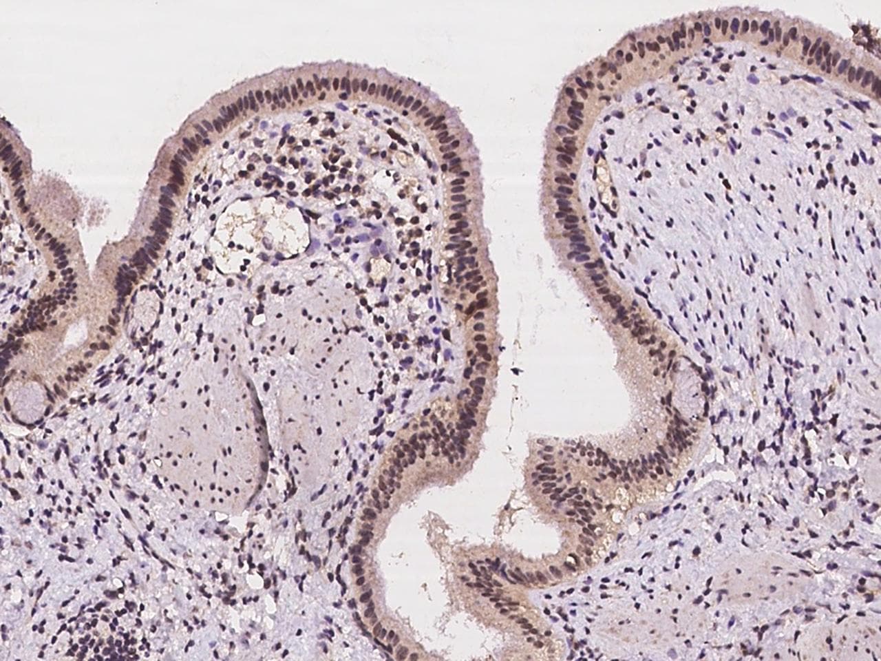 Polyclonal Rabbit anti-Human VSTM2L Antibody (IHC)