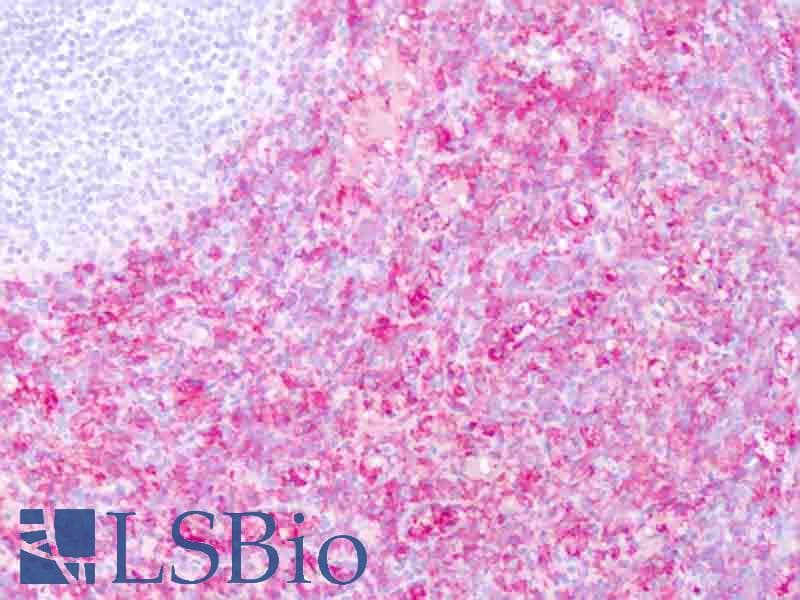 IHC-plus™ CD16 Antibody (clone DJ130c)