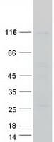 Human GAA / Alpha-Glucosidase, Acid Protein (Recombinant Myc-DDK (Flag))