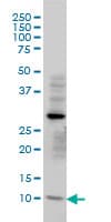 TIMM8A Antibody (clone 2F11)