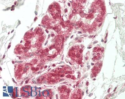 IHC-plus™ Polyclonal Rabbit anti-Human CNOT8 Antibody (IHC, WB)