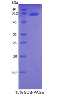 Mouse ESM1 / Endocan Protein (Recombinant His-MBP)