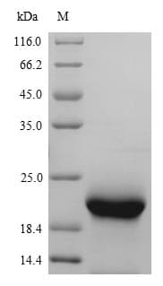 Mouse MB / Myoglobin Protein (Recombinant 6His, N-terminus + Myc, C-terminus)