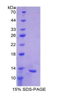 Mouse CXCL11 Protein (Recombinant His-T7)