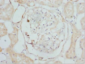CYP4V2 Antibody