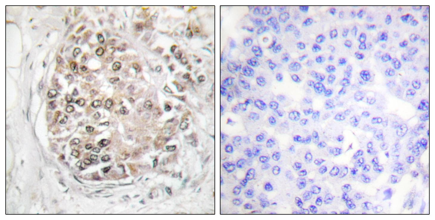 PRKDC / DNA-PKcs Antibody (phospho-Ser2056)