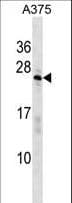 SARNP / Hcc-1 / CIP29 Antibody (aa81-110)