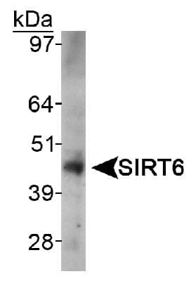 SIRT6 / Sirtuin 6 Antibody (Internal, Biotin)