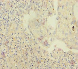 SKIV2L / SKI2 Antibody