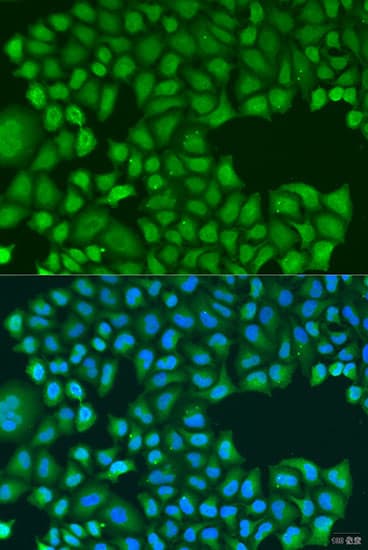 Polyclonal Rabbit anti-Human TIRAP Antibody (IHC, IF, WB)