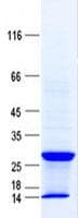 Human UBE2U Protein (Recombinant His, N-Terminal)