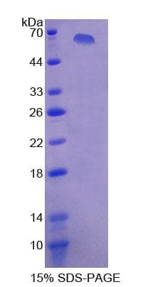 Human XDH / Xanthine Oxidase Protein (Recombinant His-GST)