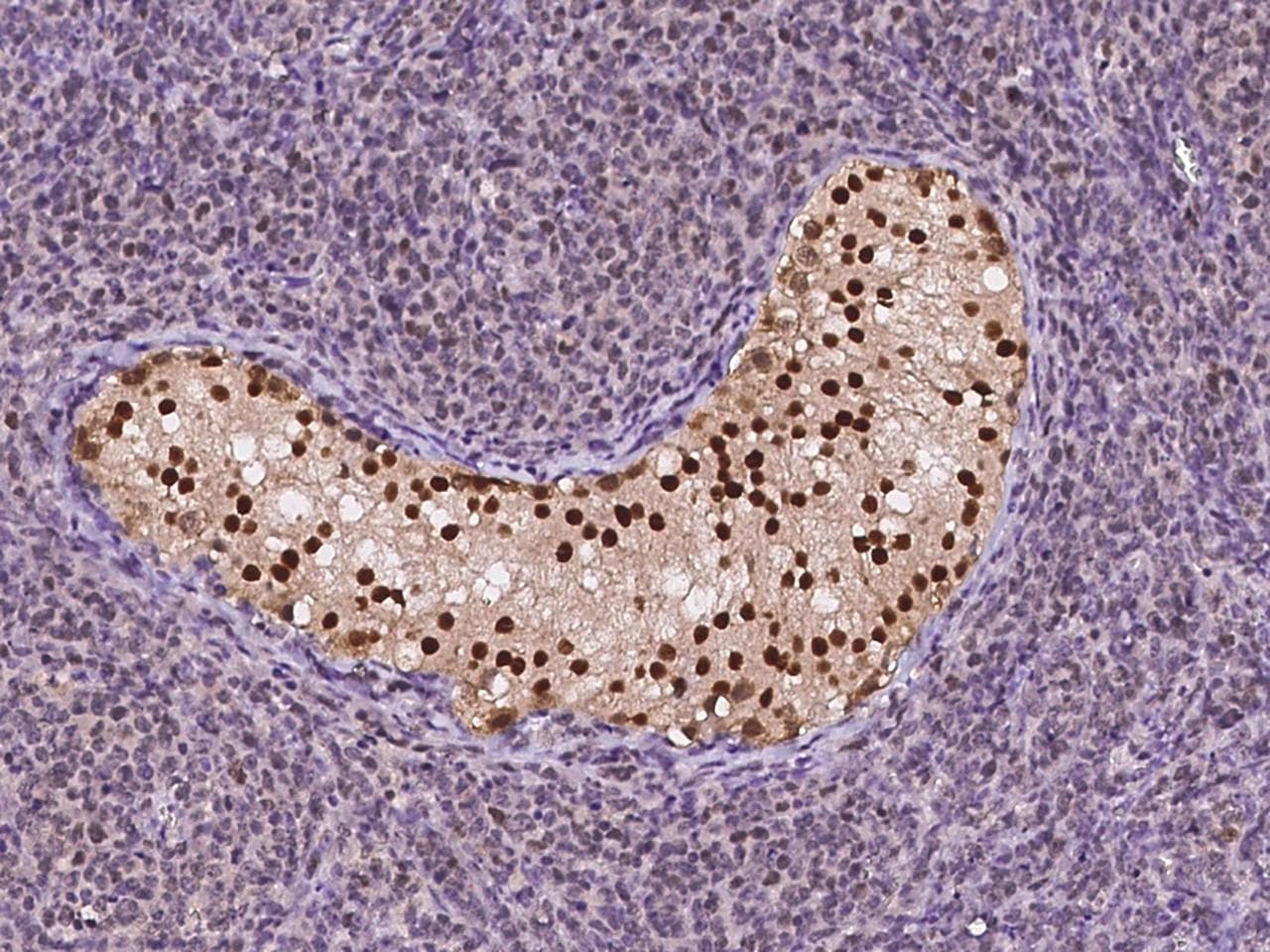 TSPYL2 / DENTT Antibody