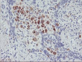 ACSF2 Antibody (clone OTI6E4, Carrier-free)