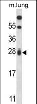 RIT1 Antibody (aa41-70)